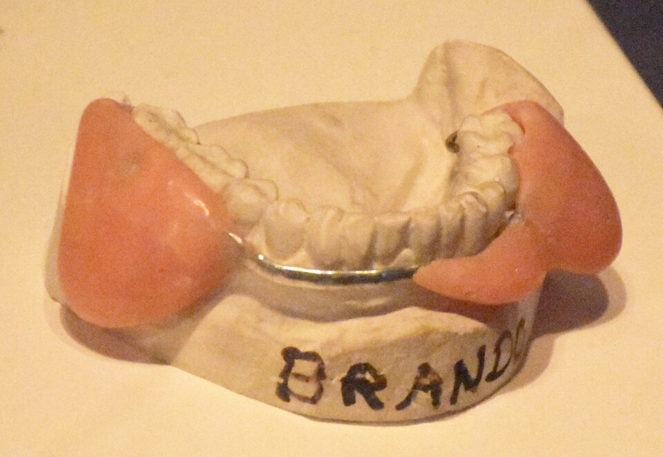 Marlon Brando's dental plumper for 'Godfather' -2
